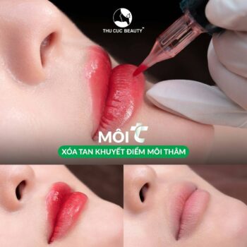 Cấy môi sinh học ở đâu đẹp?