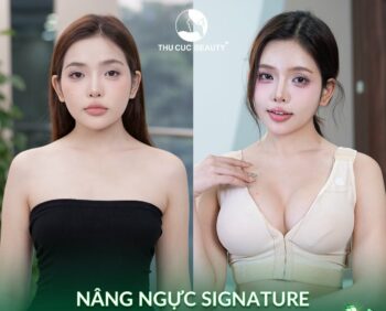 Ngực lép có nên nâng ngực không? Cần lưu ý những gì?