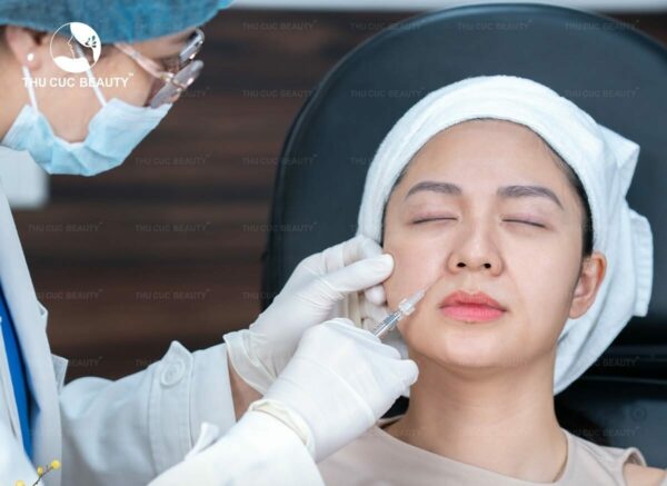 Tiêm rãnh cười sâu 